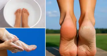 Pédicure maison au bicarbonate de soude : des pieds doux et lisses sans dépenser une fortune